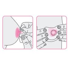 Pezonera para prematuro